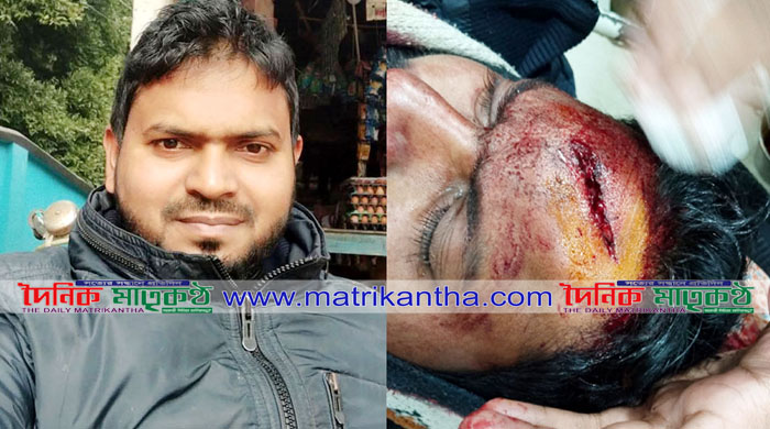 মদাপুরে বিকাশ ব্যবসায়ীকে  গুলি করে টাকা ছিনতাই